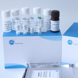 Παρακινητικό FDA εξαρτήσεων μ-ΚΠΣ ELISA παράγοντα αποικιών μακρόφαγων εγκεκριμένο
