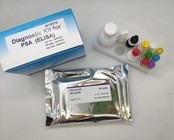 Εξάρτηση εγχώριας δοκιμής της Elisa αντιγόνων πυρήνων ιών ηπατίτιδας Β 96 κομμάτια υψηλή αποδοτικότητα