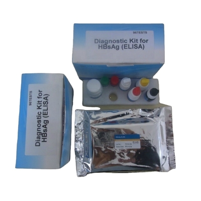 Immunoassay εξαρτήσεων ερευνητικού διαγνωστική Hbsag Elisa ποιοτική ενζυμικό ανθρώπινη χρήση