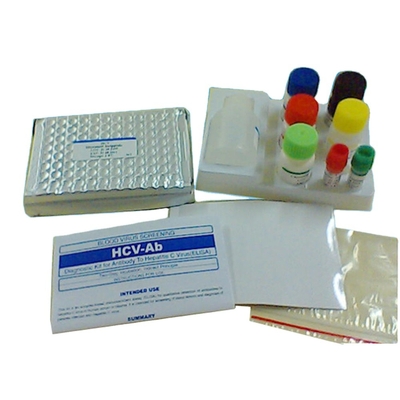 Immunoassay εξαρτήσεων ερευνητικού διαγνωστική Hbsag Elisa ποιοτική ενζυμικό ανθρώπινη χρήση