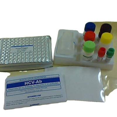 Interleukin 1 βήτα ανθρώπινη Il1b Elisa ανίχνευσης elisa χρήση Reaserch εξαρτήσεων εξαρτήσεων